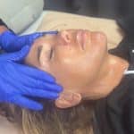 Ventouse thérapie rendezvousbeautee