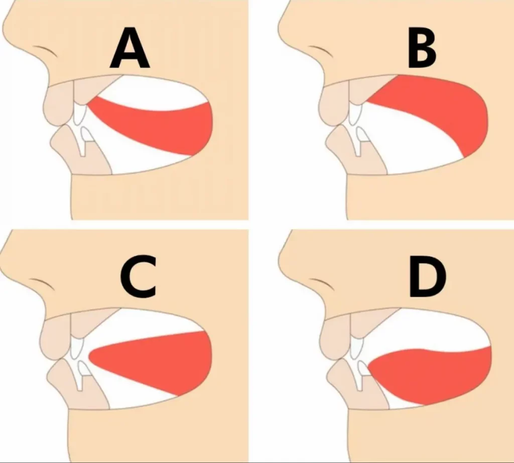Image en 4 blocs montrant différentes positions de la langue dans la bouche : bloc 1, langue basse et avancée ; bloc 2, langue au milieu ; bloc 3, langue partiellement en haut ; bloc 4, langue correctement positionnée contre le palais. Illustration éducative sur la posture de la langue, servant à poser la question : où est-ce que tu places ta langue dans ta bouche ?